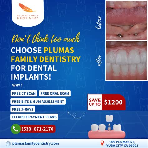 yuba city dental implants cost|Costs & Pricing in Yuba City, CA .